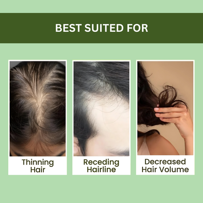 Rosemary Hair Regrowth Spray 100ml – Buy 1 Get 2 FREE!