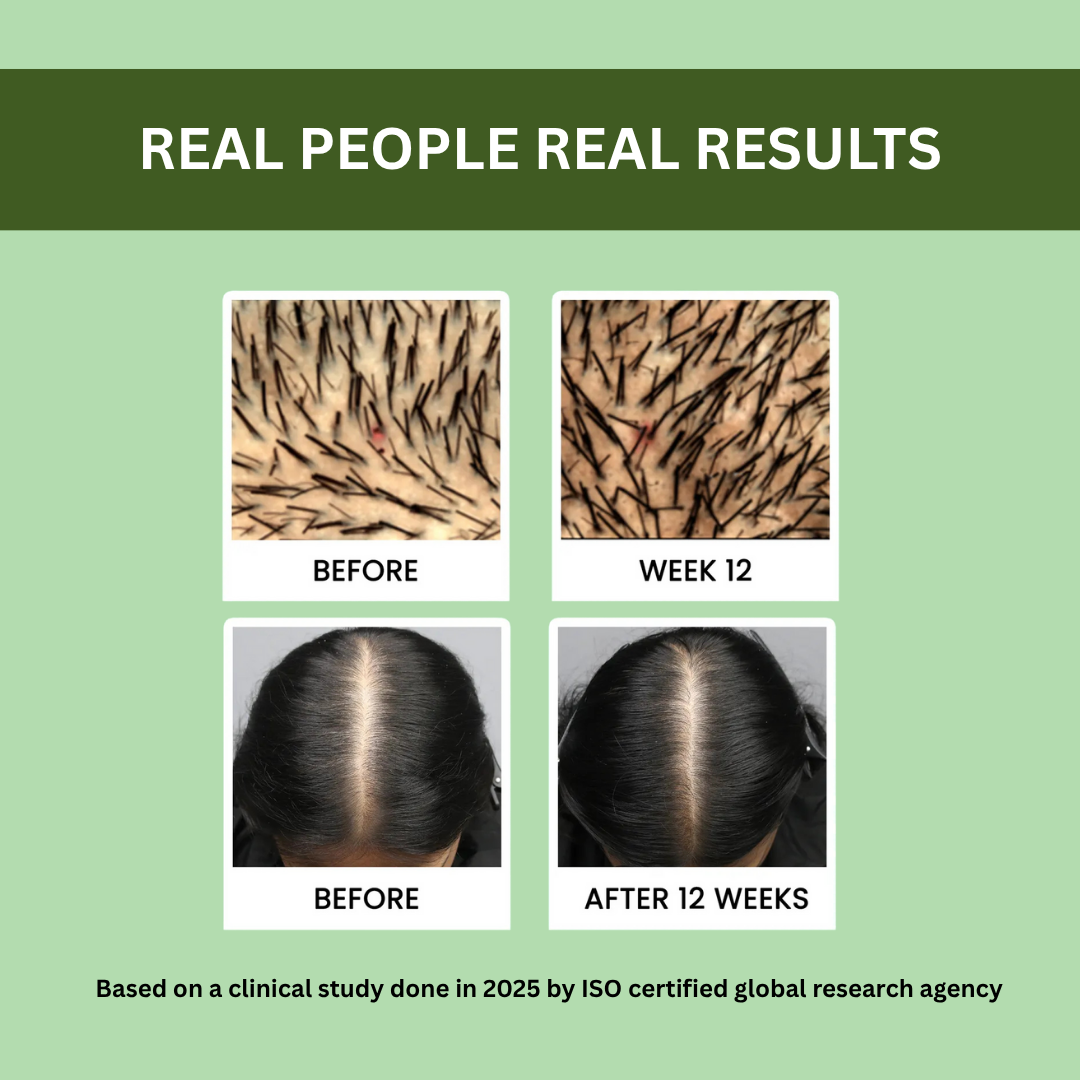 Rosemary Hair Regrowth Spray 100ml – Buy 1 Get 2 FREE!