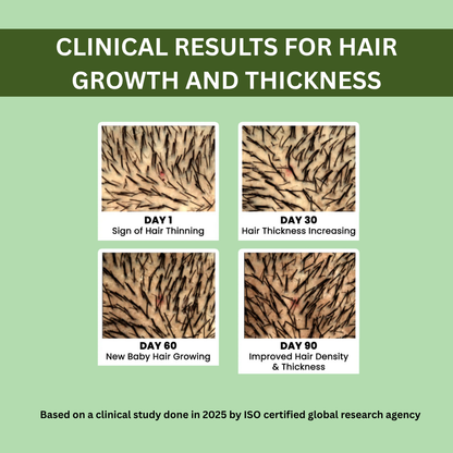 Rosemary Hair Regrowth Spray 100ml – Buy 1 Get 2 FREE!